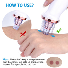 Electric Blackhead Suction Tool